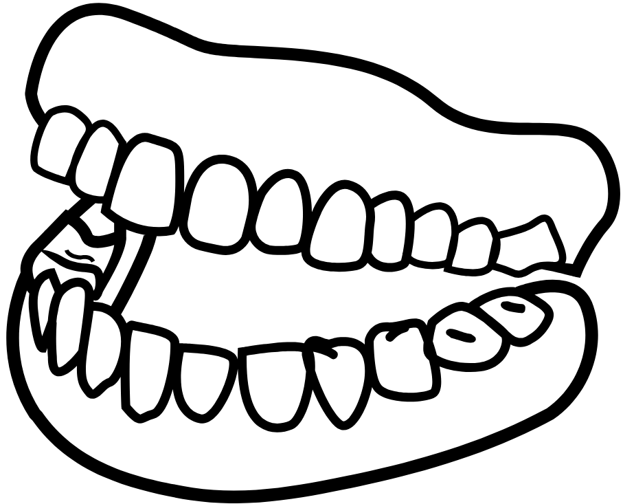 Full Mouth Rehabilitation